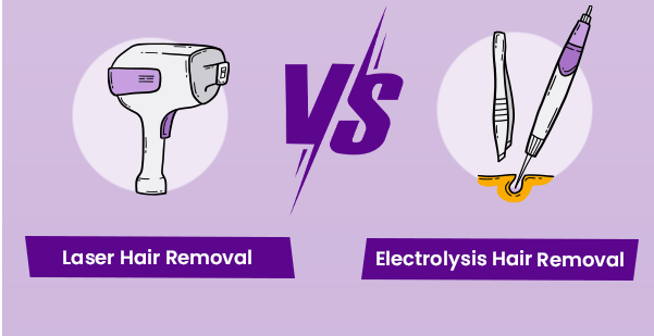 laser hair removal vs electrolysis comparison